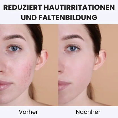 LuxeDream™ Polyester-Satinbettwäsche