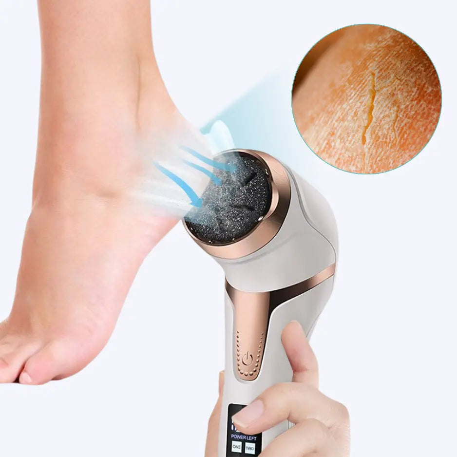 Elektrischer Hornhaut Entferner - PediPro™