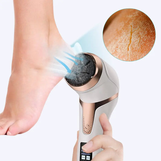 Elektrischer Hornhaut Entferner - PediPro™