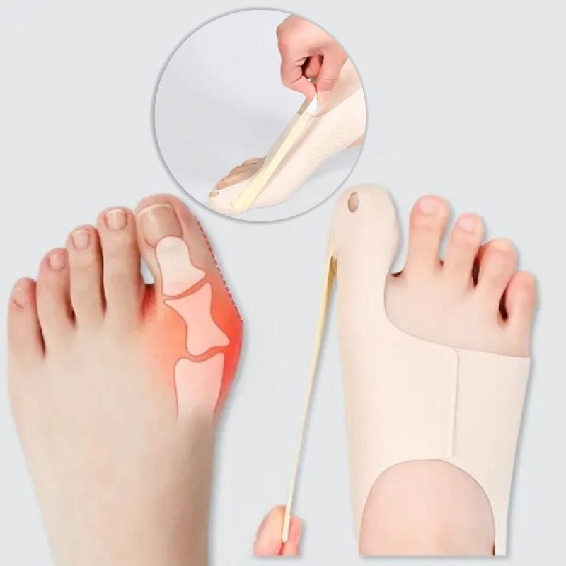 ValgusVital™ Hallux-Korrektor